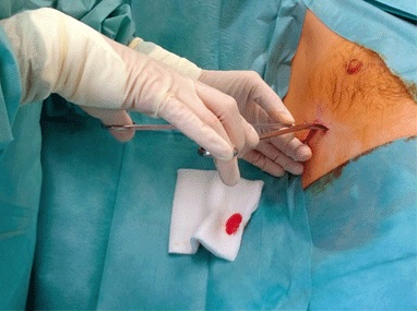thoracic2.jpg